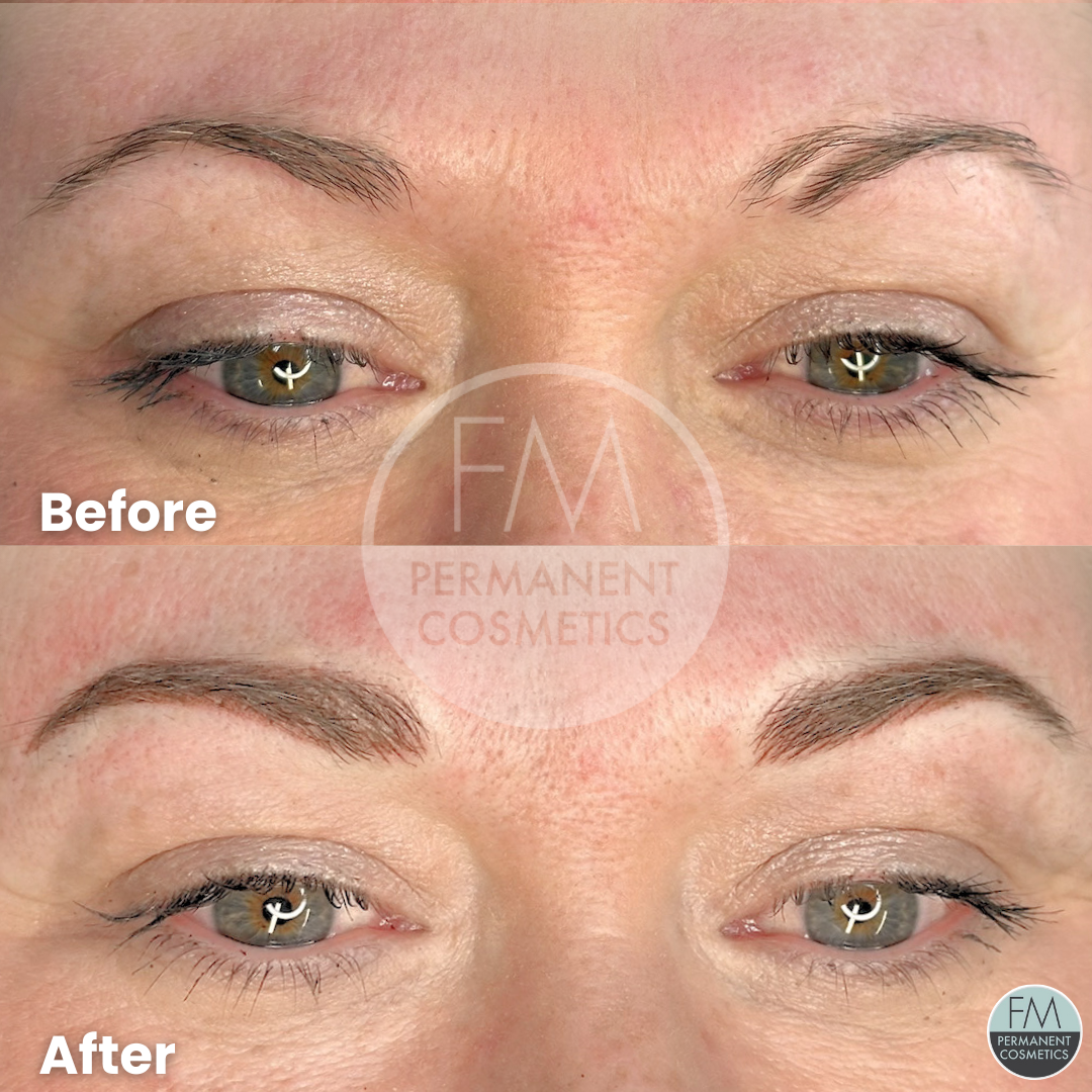 scar camouflage using combination eyebrows