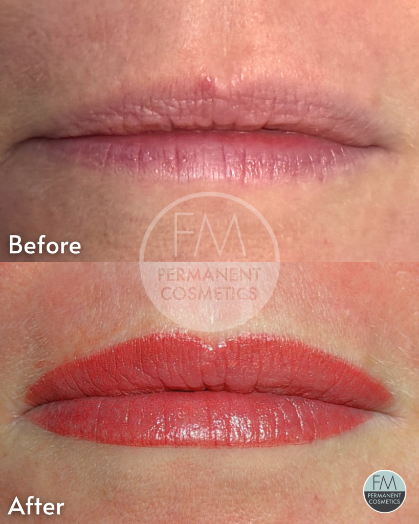 lips before and after